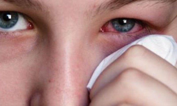 congiuntivite-omeopatia-1728x800_c